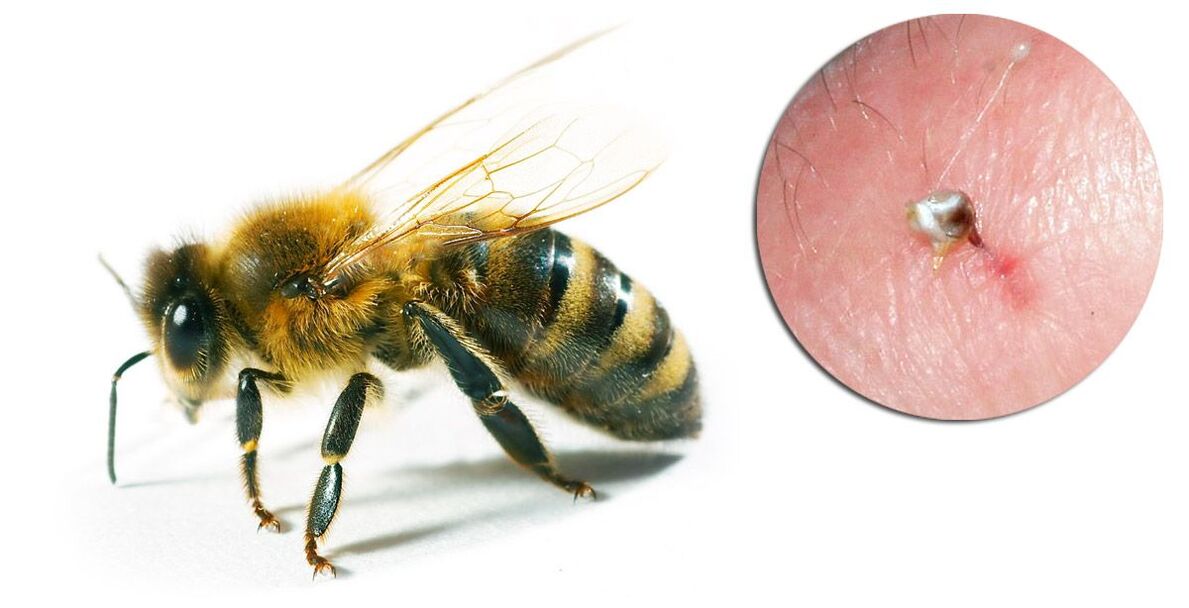 Hondrostrong contiene veneno de abeja, que mejora los procesos metabólicos en los tejidos. 