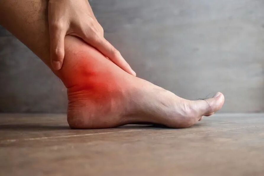 artrosis de la articulación del tobillo