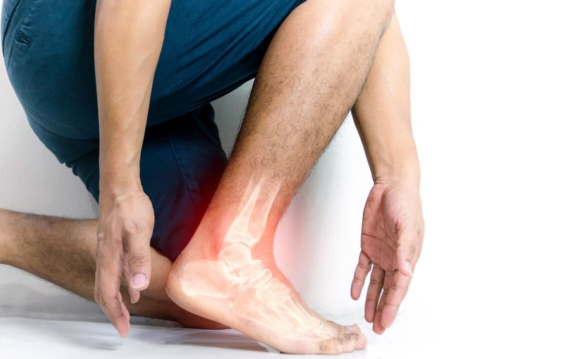 clasificación de la artrosis de tobillo