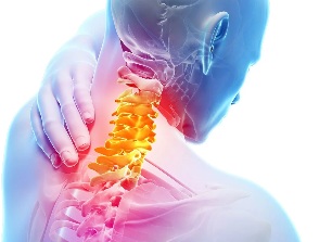 La osteocondrosis cervical